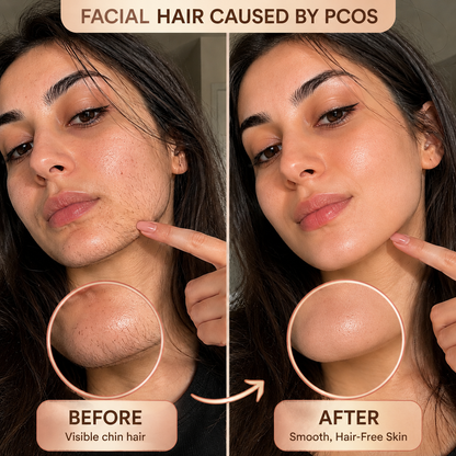 Rose Lume™ Facial Hair Remover