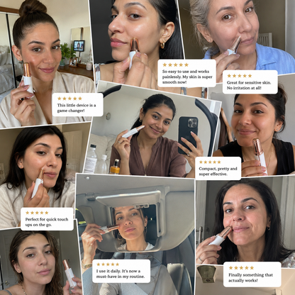 Rose Lume™ Facial Hair Remover