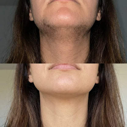 Rose Lume™ Facial Hair Remover
