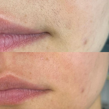 Rose Lume™ Facial Hair Remover